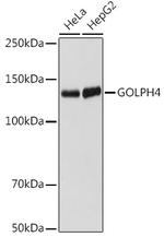 GOLIM4 Recombinant Rabbit Monoclonal Antibody (10J7E6)