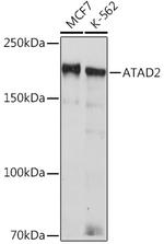 ATAD2 Recombinant Rabbit Monoclonal Antibody (2K7T2)