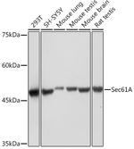SEC61alpha Recombinant Rabbit Monoclonal Antibody (9W7I3)