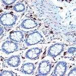 Tryptase Recombinant Rabbit Monoclonal Antibody (6U1C5)