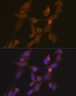 STK33 Recombinant Rabbit Monoclonal Antibody (1E4W7)