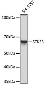 STK33 Antibody in Western Blot (WB)