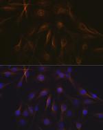 TUBB1 Antibody in Immunocytochemistry (ICC/IF)