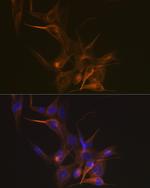 TUBB1 Antibody in Immunocytochemistry (ICC/IF)