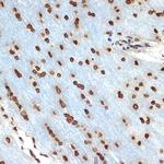 Histone H2B Antibody in Immunohistochemistry (Paraffin) (IHC (P))