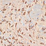 MSI2 Antibody in Immunohistochemistry (Paraffin) (IHC (P))