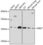 NEK7 Recombinant Rabbit Monoclonal Antibody (7Y3B10)