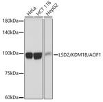 KDM1B Recombinant Rabbit Monoclonal Antibody (5M3W2)