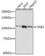 TAB3 Recombinant Rabbit Monoclonal Antibody (3Y6T7)