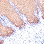 Cytokeratin 6 Recombinant Rabbit Monoclonal Antibody (3F7A1)