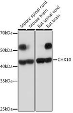 CHX10 Recombinant Rabbit Monoclonal Antibody (4Z4R2)