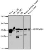 MEK3/MEK6 Recombinant Rabbit Monoclonal Antibody (8R1J5)