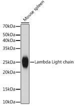 Lambda Light Chain Antibody in Western Blot (WB)