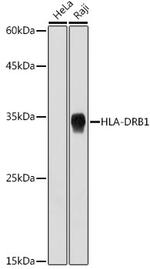 HLA-DRB1 Antibody in Western Blot (WB)
