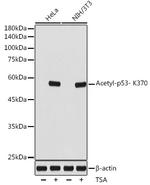 Acetyl-p53 (Lys370) Recombinant Rabbit Monoclonal Antibody (9X9X3)