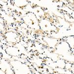 FADD Antibody in Immunohistochemistry (Paraffin) (IHC (P))