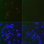 SARS-CoV-2 Nucleocapsid Monoclonal Antibody (7P1G6)