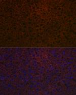 Ceruloplasmin Antibody in Immunohistochemistry (Paraffin) (IHC (P))