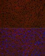 Ceruloplasmin Antibody in Immunohistochemistry (Paraffin) (IHC (P))