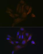 BAP31 Recombinant Rabbit Monoclonal Antibody (7R10K2)