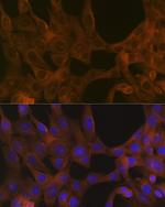 ACVR1B Recombinant Rabbit Monoclonal Antibody (3U6I8)