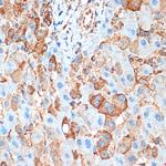 ACVR1B Antibody in Immunohistochemistry (Paraffin) (IHC (P))