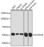 ACVR1B Antibody in Western Blot (WB)