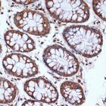 HSPA14 Antibody in Immunohistochemistry (Paraffin) (IHC (P))