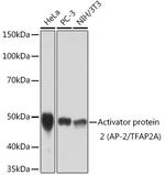 AP2 alpha Recombinant Rabbit Monoclonal Antibody (8I8E4)