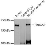 ARHGAP5 Antibody in Immunoprecipitation (IP)