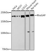 ARHGAP5 Recombinant Rabbit Monoclonal Antibody (3L9I3)