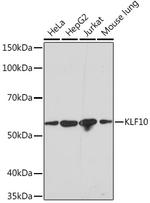 KLF10 Recombinant Rabbit Monoclonal Antibody (2Y1Q6)