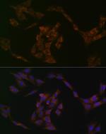 IRF6 Antibody in Immunocytochemistry (ICC/IF)