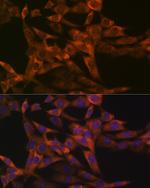 IRF6 Antibody in Immunocytochemistry (ICC/IF)