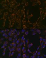 CLPP Recombinant Rabbit Monoclonal Antibody (1W6O4)