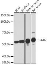 EGR2 Recombinant Rabbit Monoclonal Antibody (1F6V7)