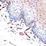 H-cadherin Recombinant Rabbit Monoclonal Antibody (4Z8D1)