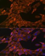 WFDC2 Recombinant Rabbit Monoclonal Antibody (6K2F5)