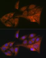 WFDC2 Antibody in Immunocytochemistry (ICC/IF)