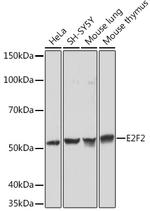 E2F2 Recombinant Rabbit Monoclonal Antibody (1H7D6)
