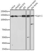 LPIN1 Recombinant Rabbit Monoclonal Antibody (4Y2U3)