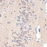 PAK3 Antibody in Immunohistochemistry (Paraffin) (IHC (P))