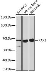 PAK3 Antibody in Western Blot (WB)