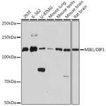 MIB1 Recombinant Rabbit Monoclonal Antibody (9Q4N9)