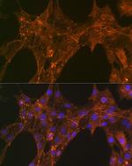 alpha Actinin 4 Antibody in Immunocytochemistry (ICC/IF)