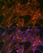 alpha Actinin 4 Recombinant Rabbit Monoclonal Antibody (5Y3R6)