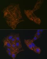 alpha Actinin 4 Antibody in Immunocytochemistry (ICC/IF)