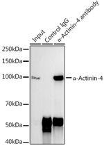 alpha Actinin 4 Antibody in Immunoprecipitation (IP)