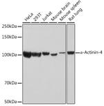 alpha Actinin 4 Antibody in Western Blot (WB)
