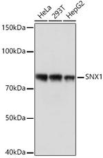 SNX1 Recombinant Rabbit Monoclonal Antibody (8G8Z2)